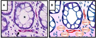 Angiocrine Regulation of Epithelial Barrier Integrity in Inflammatory Bowel Disease